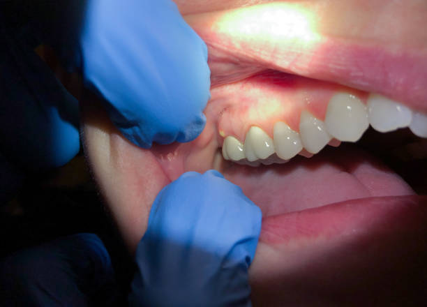 Best Emergency Pediatric Dental Care in Solomon, KS