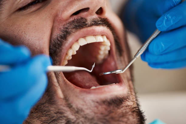 Best Urgent Dental Care for Toothaches in Solomon, KS